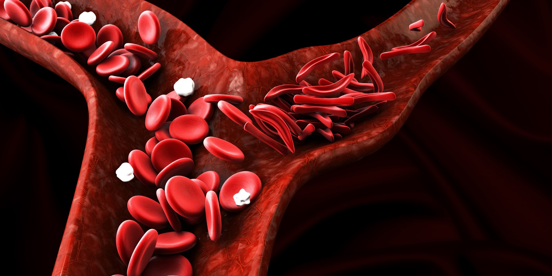 anemija-leukemija-limfomi-specijalna-bolnica-medico