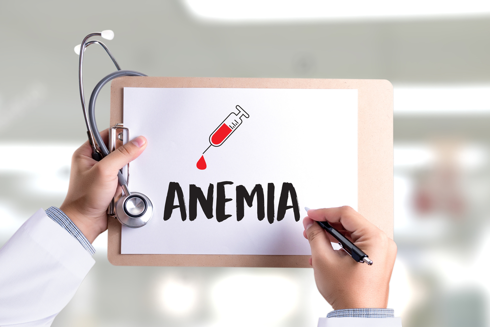 Anemija pogađa 30 posto stanovništva! Kako do dijagnoze ako sumnjate na ovu bolest?